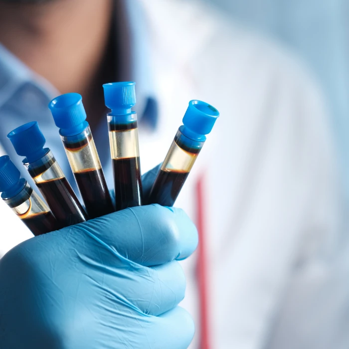  TESTY DIAGNOSTYCZNE - Jak uniknąć roznoszenia wirusów w szkole?