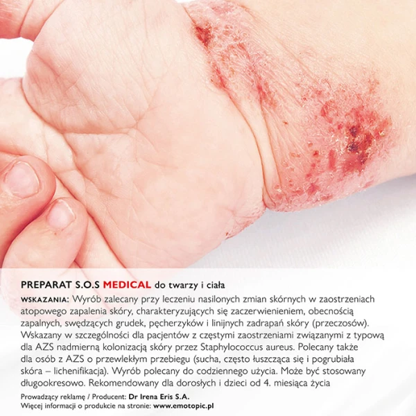 PHARMACERIS E EMOTOPIC BACTERIA CONTROL PREPARAT S.O.S. 30 ML